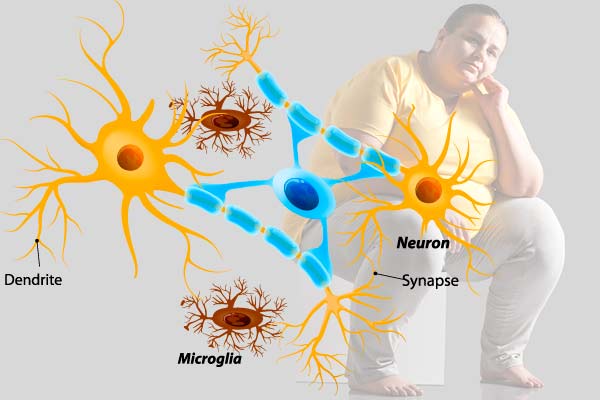 Mikrogliaer er normalt ekstremt effektive og aktive, men med fedme bliver de dovne og rydder ikke op i hjernen.